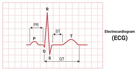 ecg bella|EKG (electrocardiogram) .